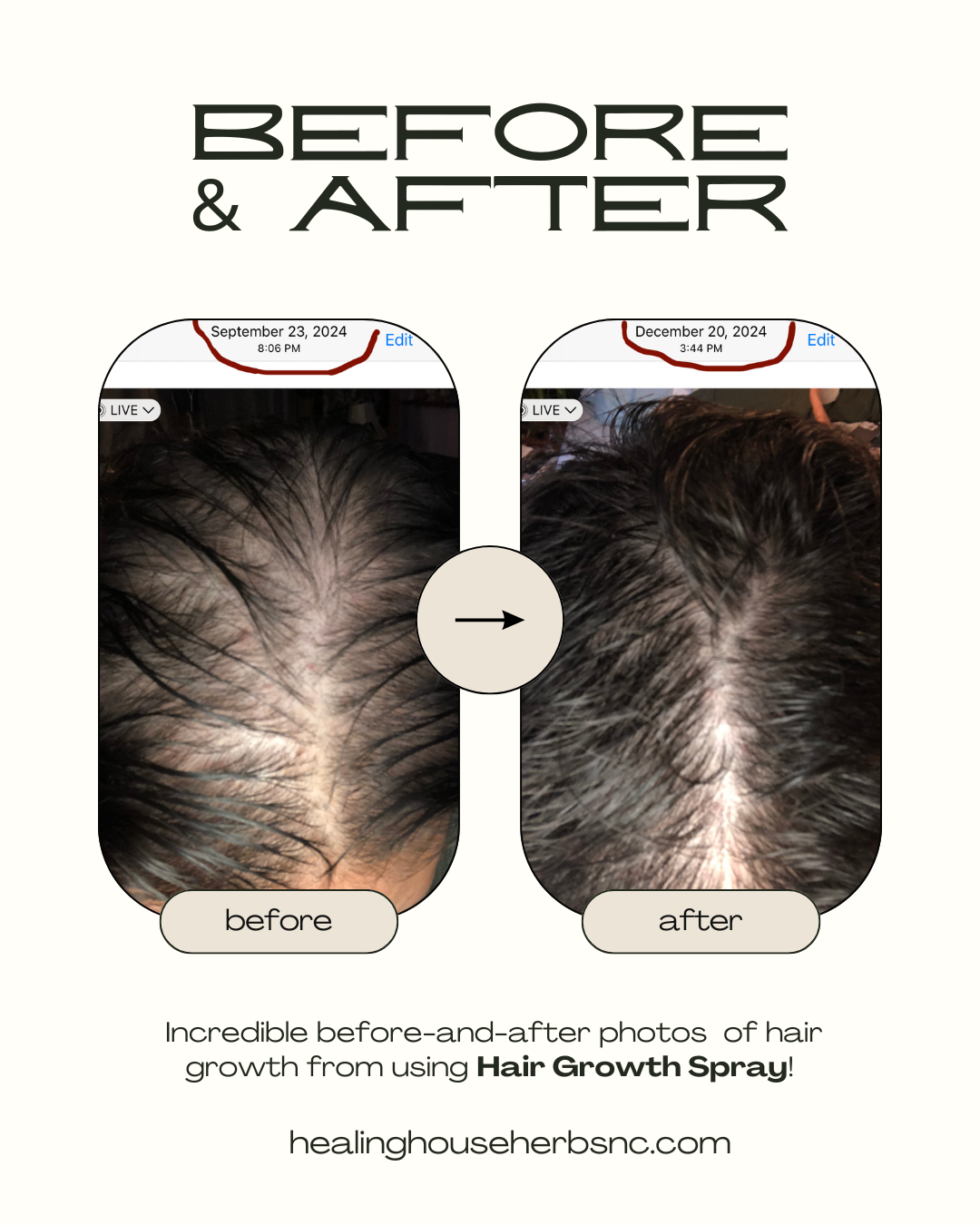 Hair Growth Spray